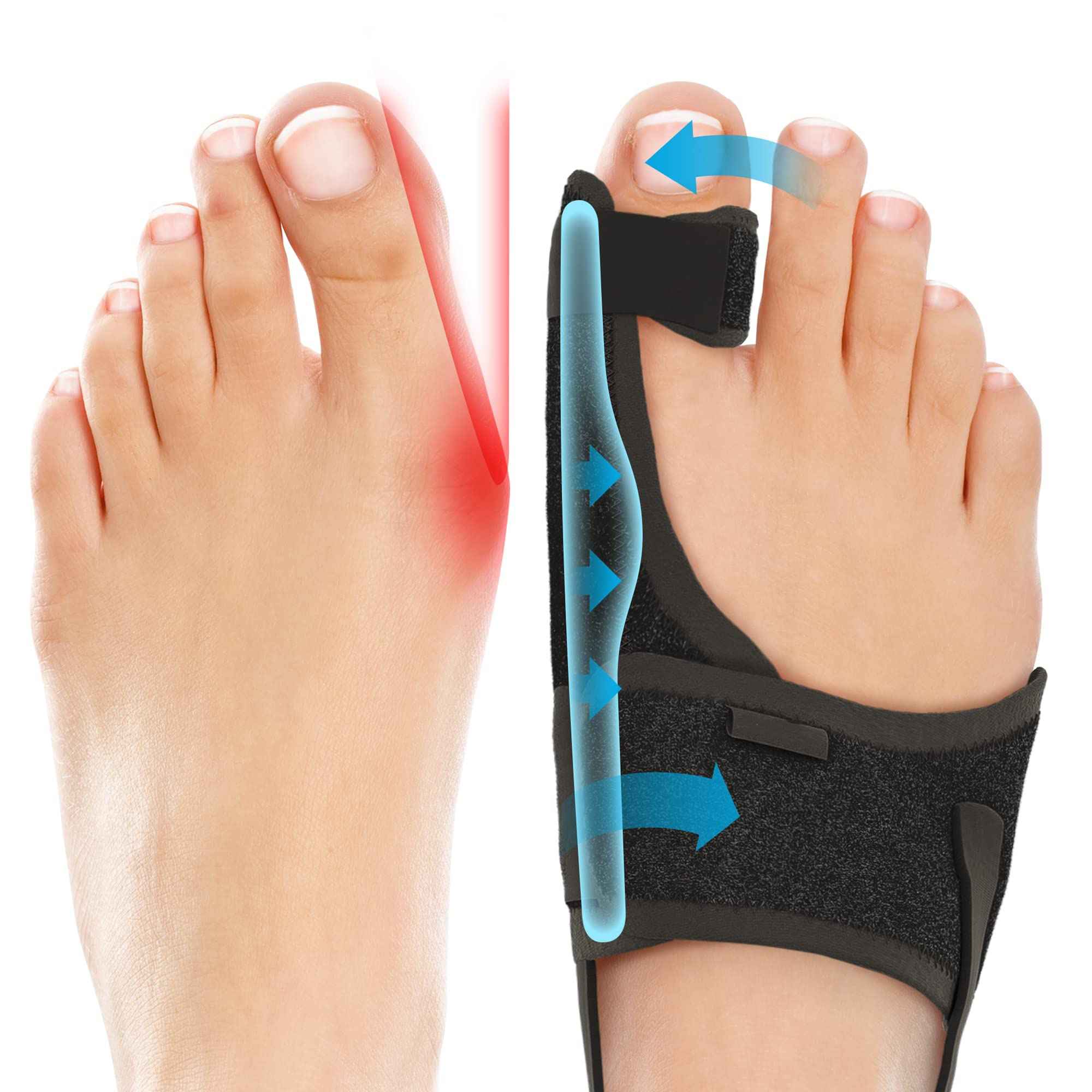 Big Toe Hallux Valgus Corrector Orthosis Adjustable Rotating Buckle Day and Night Use Bone Separator Bunion Protector