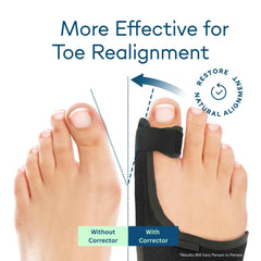 Big Toe Hallux Valgus Corrector Orthosis Adjustable Rotating Buckle Day and Night Use Bone Separator Bunion Protector